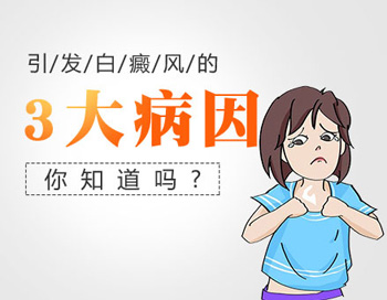 溫州哪家醫院治療白癜風好